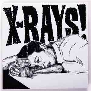 X-Rays - Jameson Shot