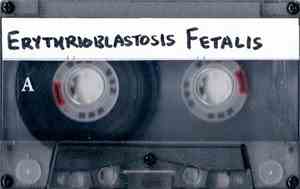 Erythrioblastosis Fetalis - Infantile Digital Fibromatosis