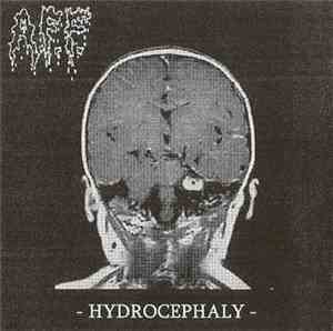 A.F.F. - Hydrocephaly