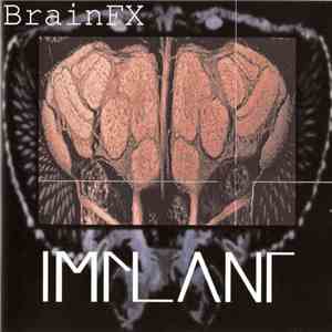 Implant - BrainFX