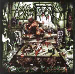 Dieresis - Loose Limbs