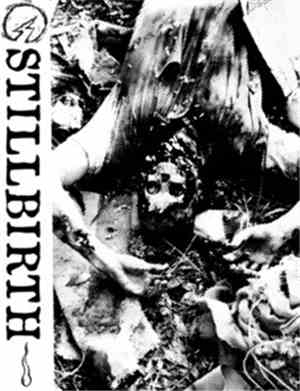 Stillbirth - Stillbirth