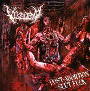 Vulvectomy - Post-Abortion Slut Fuck
