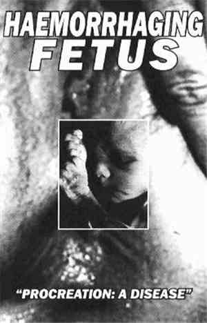 Haemorrhaging Fetus - Procreation: A Disease