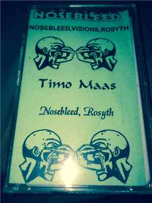 Timo Maas - Nosebleed
