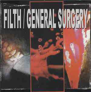 Filth  / General Surgery - Filth / General Surgery