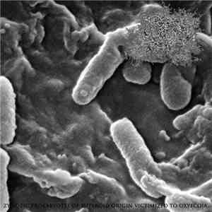 DxTxS - Zymotic Prokaryotes Of Butyroid Origin Victimized To Oxyecoia