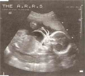 The A.R.R.S - Condition Humaine