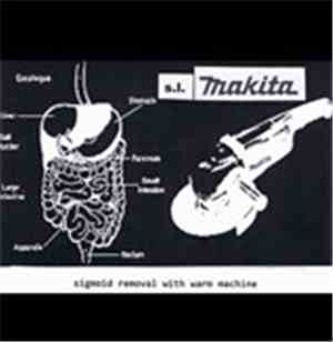 S.L. Makita - Sigmoid Removal With Warm Machine