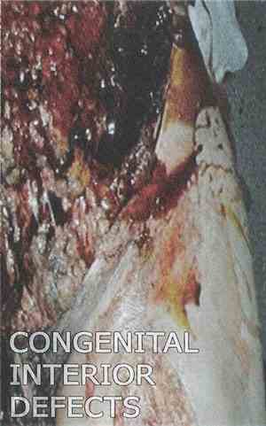 Congenital Interior Defects - Thanatophilus Rugosus