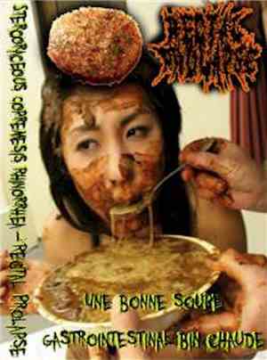 Stercoraceous Copremesis Rhinorrhea, Rectal Prolapse - Une Bonne Soupe Gast ...