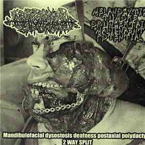 Melanocytic Tumors Of Uncertain Malignant Potential / Trabecular Hepatocell ...