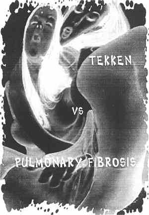 Tekken  / Pulmonary Fibrosis - Tekken Vs Pulmonary Fibrosis