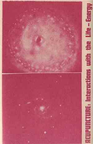 Various - Acupuncture: Interactions With The Life-Energy