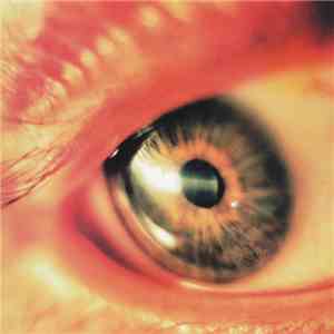 Timeblind - Rugged Redemption
