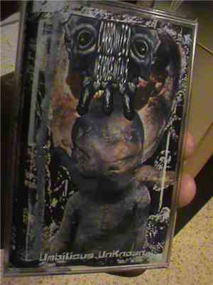 Carbonized Necrogenitals - Umbilicus Unknown